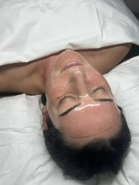 exosomas botanicos mascarilla hidrogel microneedling antiedad tratamiento facial en tamaño mediano